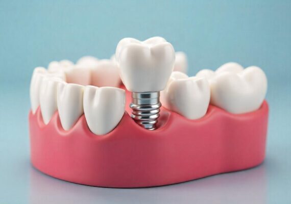 freepik__create-an-image-for-dental-implants__8550 freepik__create-an-image-for-dental-implants__8550